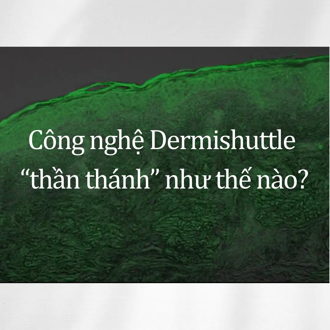 CÔNG NGHỆ DERMISHUTTLE LÀ GÌ MÀ LẠI “THẦN THÁNH” NHƯ THẾ???